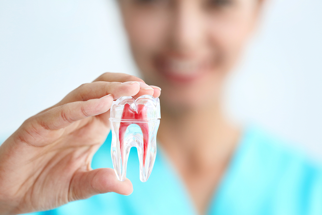 Root Canal Therapy in Saskatoon